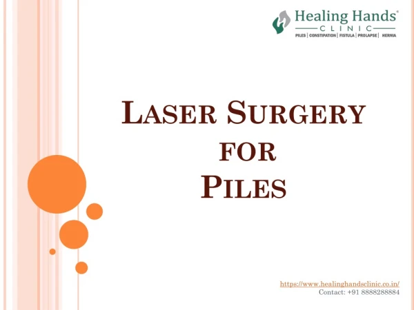 Laser Surgery for Piles