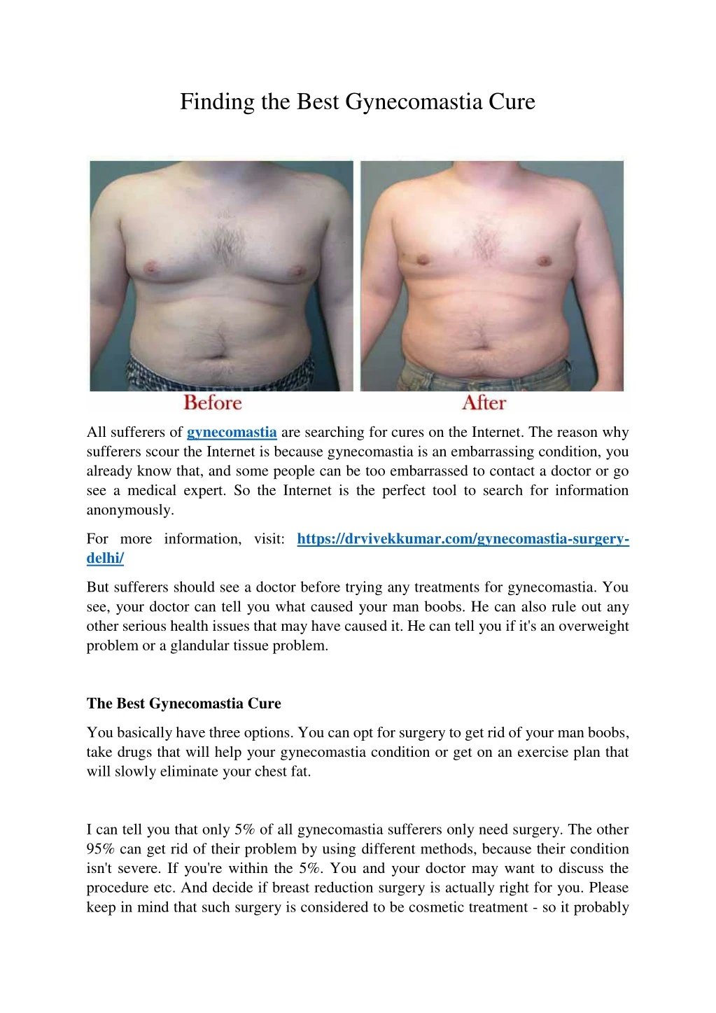 finding the best gynecomastia cure