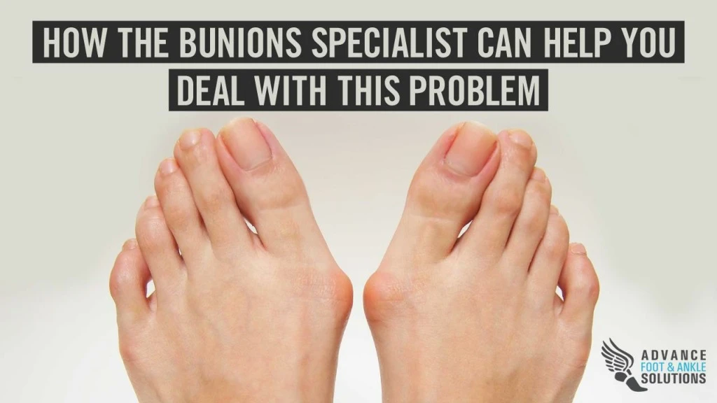 how the bunions specialist can help you deal with this problem