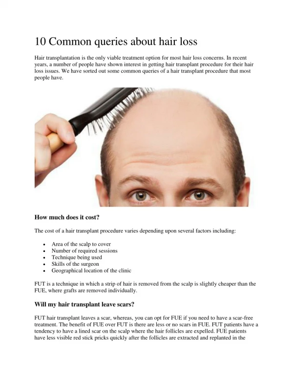 10 Common queries about hair loss