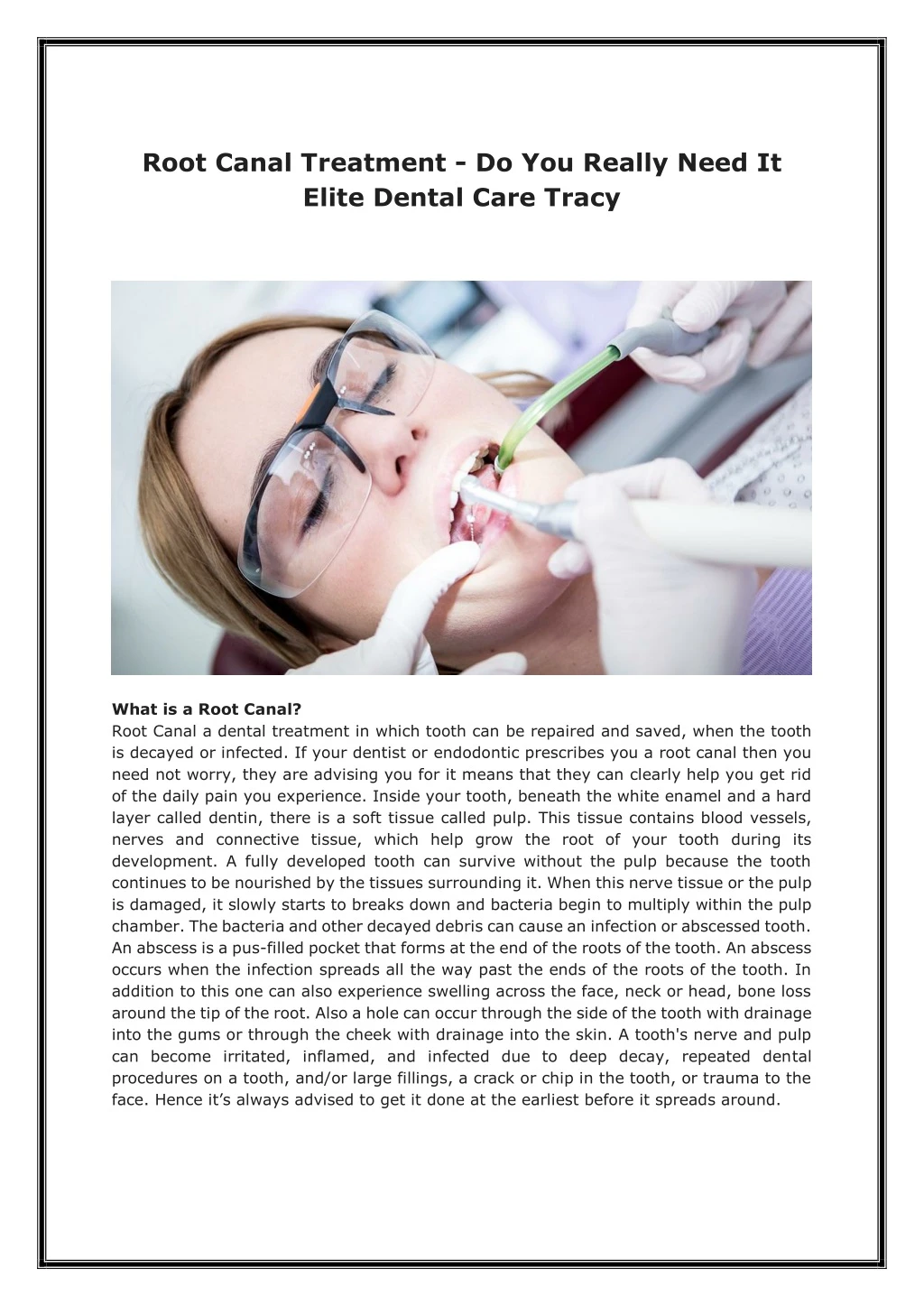 root canal treatment do you really need it elite
