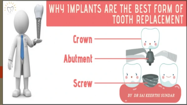 Why Implants Are The Best Method Of Tooth Replacement | Best Dental Implants in Whitefield