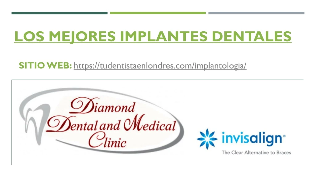 los mejores implantes dentales