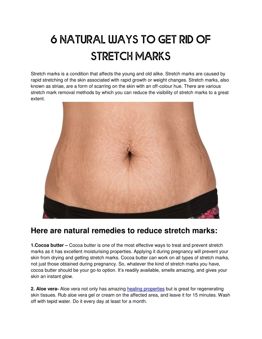 6 natural ways to get rid of stretch marks