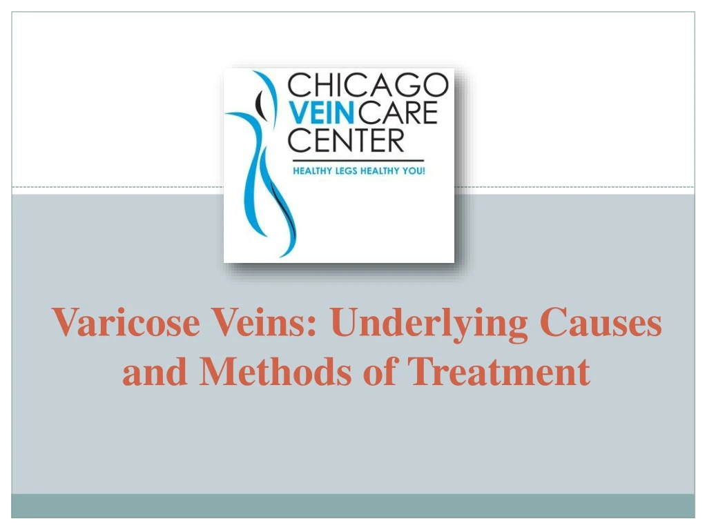 varicose veins underlying causes and methods of treatment