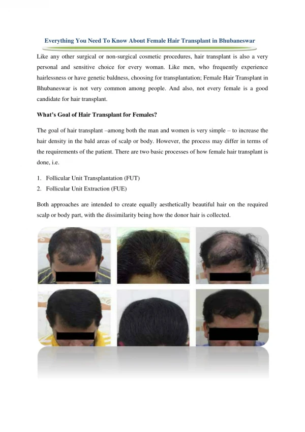 Everything You Need To Know About Female Hair Transplant in Bhubaneswar