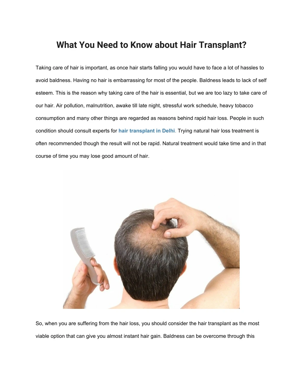 what you need to know about hair transplant
