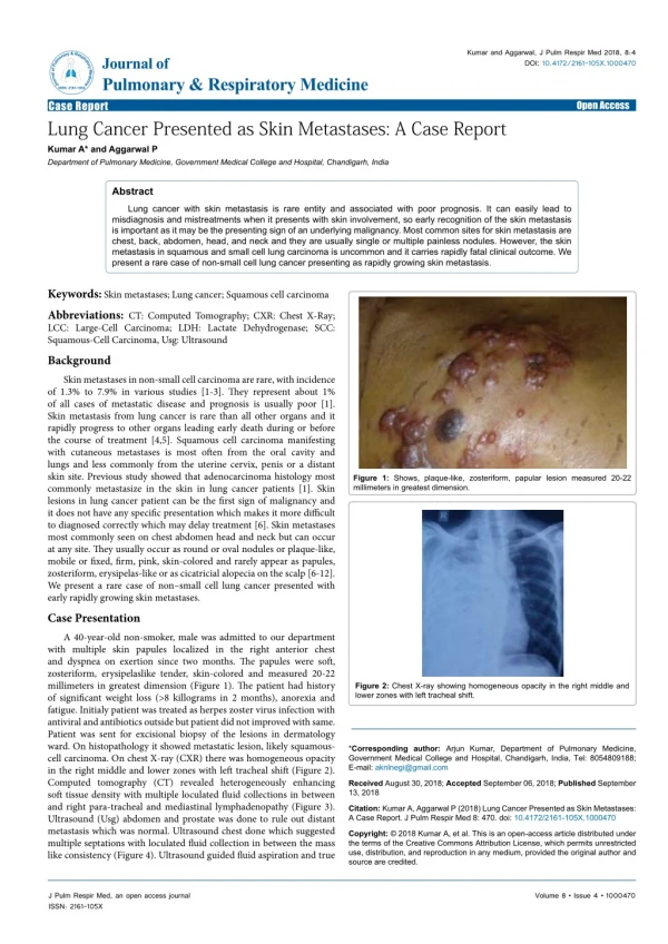 Lung Cancer Presented as Skin Metastases: A Case Report