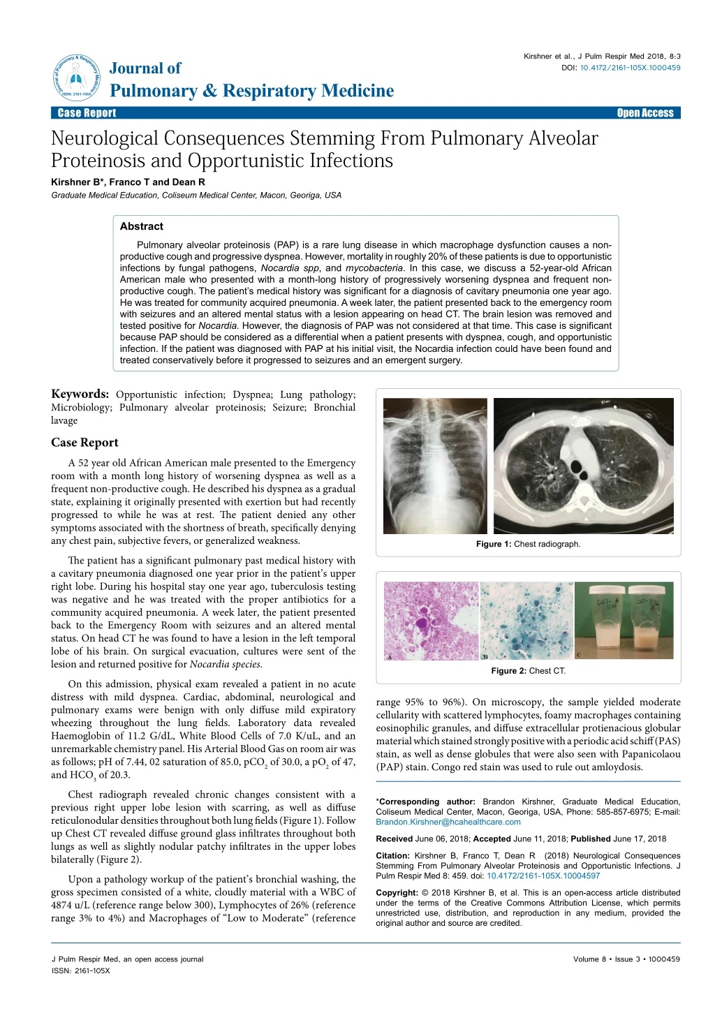 kirshner et al j pulm respir med 2018