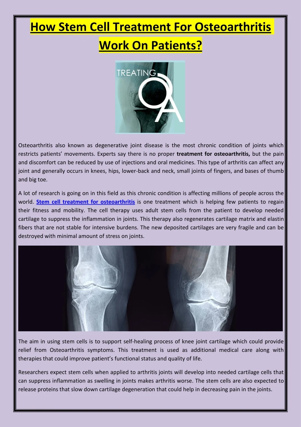 how stem cell treatment for osteoarthritis work