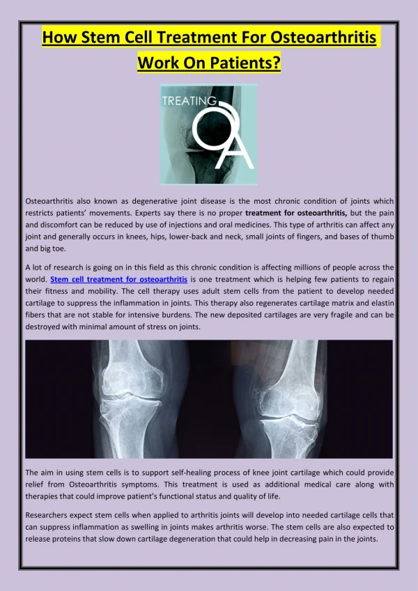 How Stem Cell Treatment For Osteoarthritis Work On Patients?