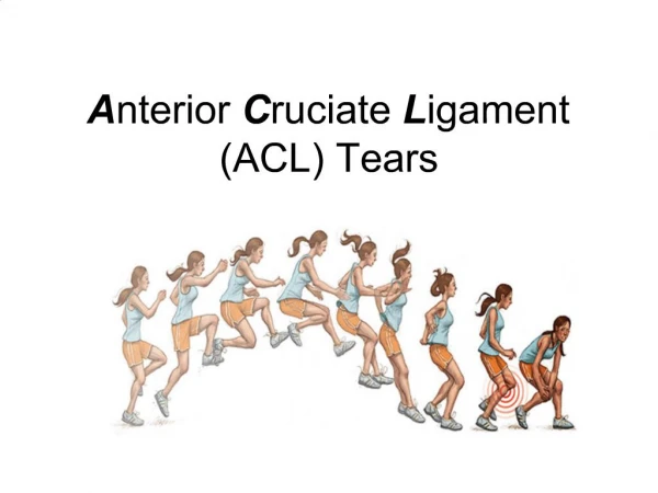 Anterior Cruciate Ligament ACL Tears