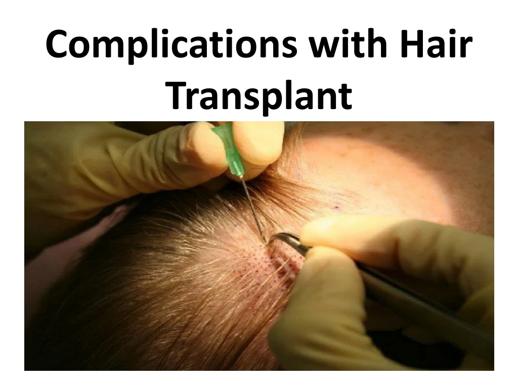 complications with hair transplant