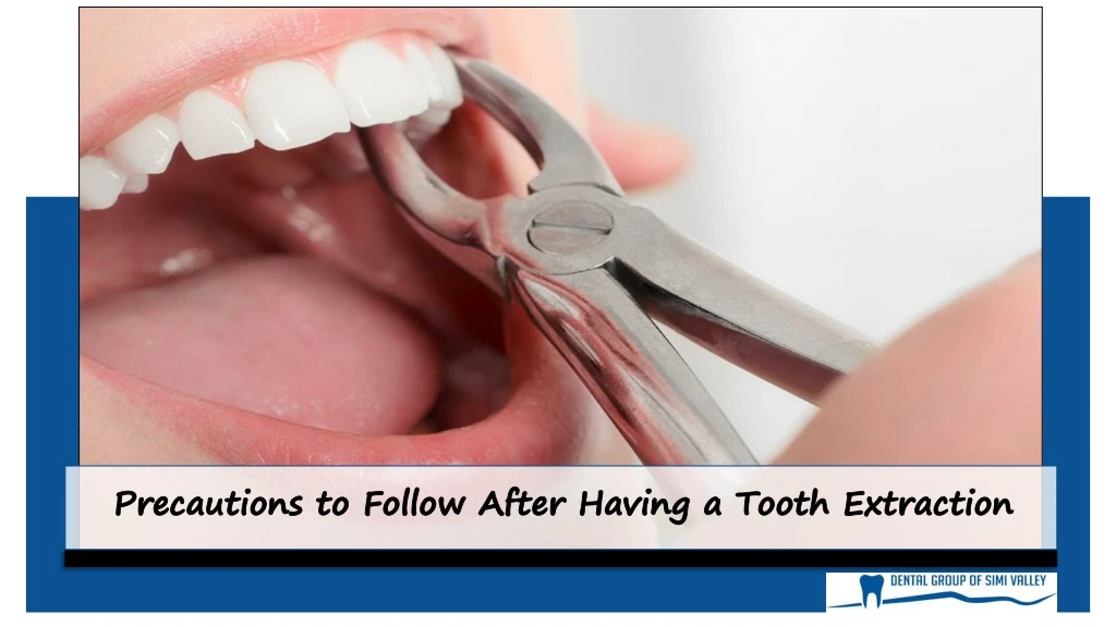 precautions to follow after having a tooth