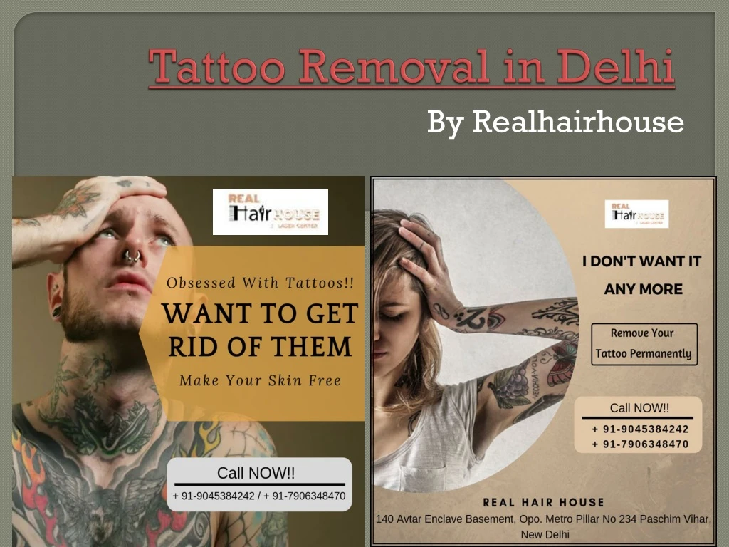 tattoo removal in delhi