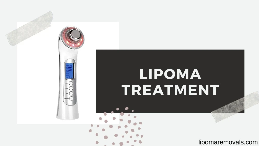 lipoma treatment