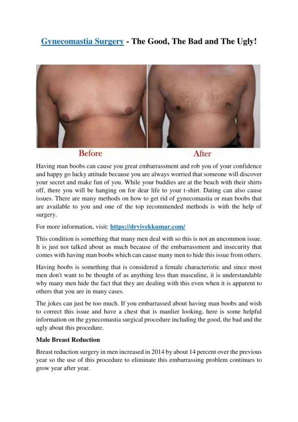 Gynecomastia Surgery - The Good, The Bad And The Ugly!