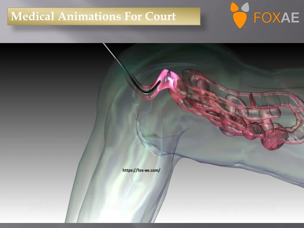 medical animations for court