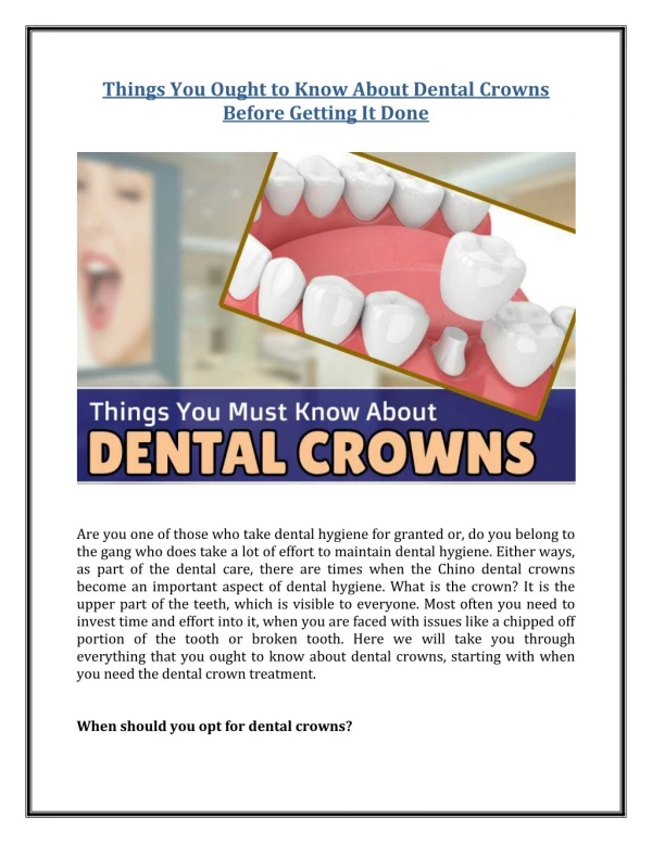 Things You Ought to Know About Dental Crowns Before Getting It Done