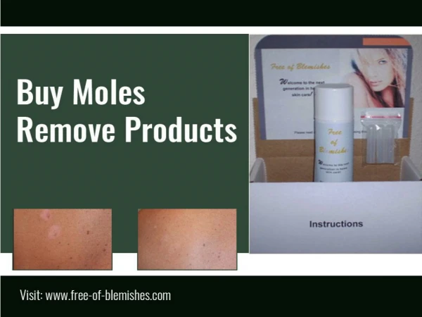 Buy Moles remove products and remove your mole tags effectively