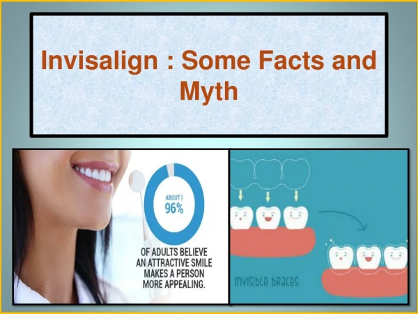 Invisalign - Some Facts and Myth by Chandler Orthodontics