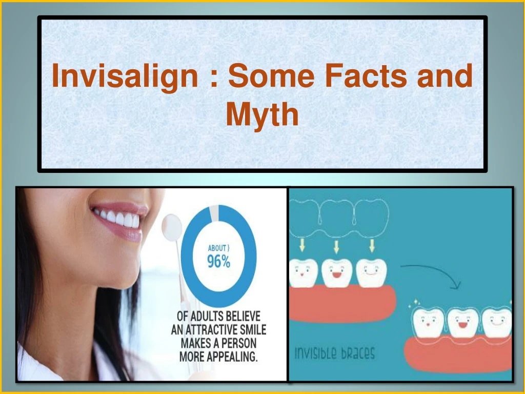 invisalign some facts and myth