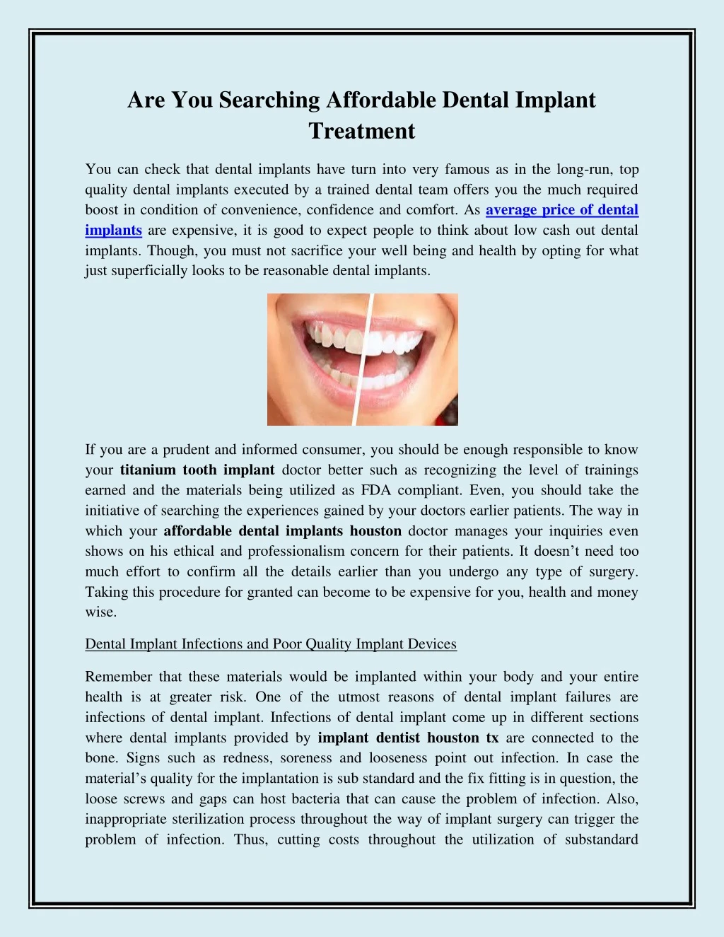 are you searching affordable dental implant
