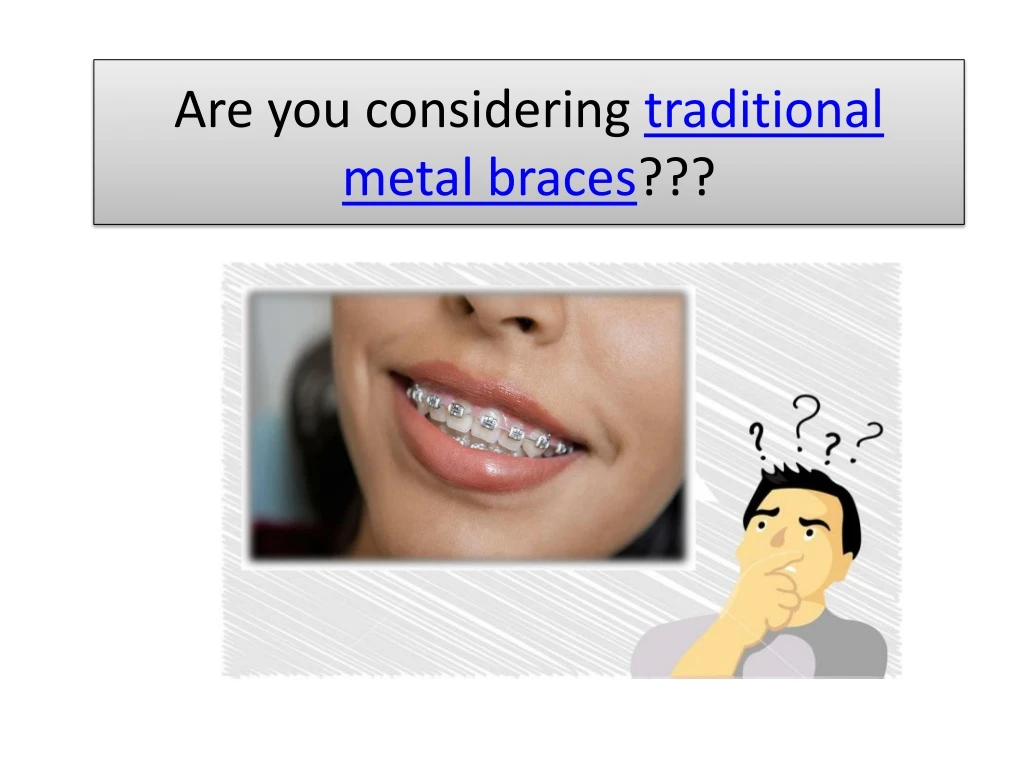 are you considering traditional metal braces