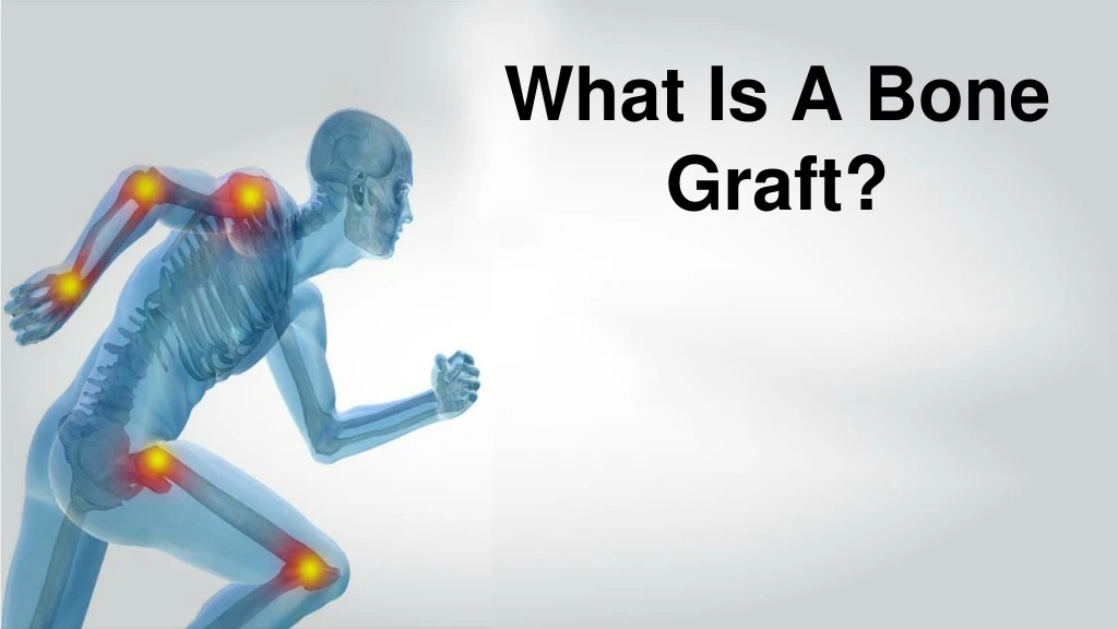 what is a bone graft