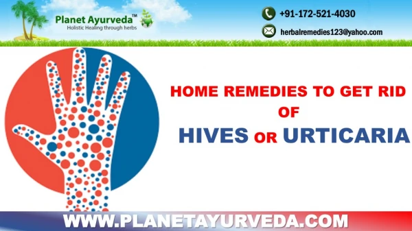 Home Remedies to Get Rid of Hives or Urticaria
