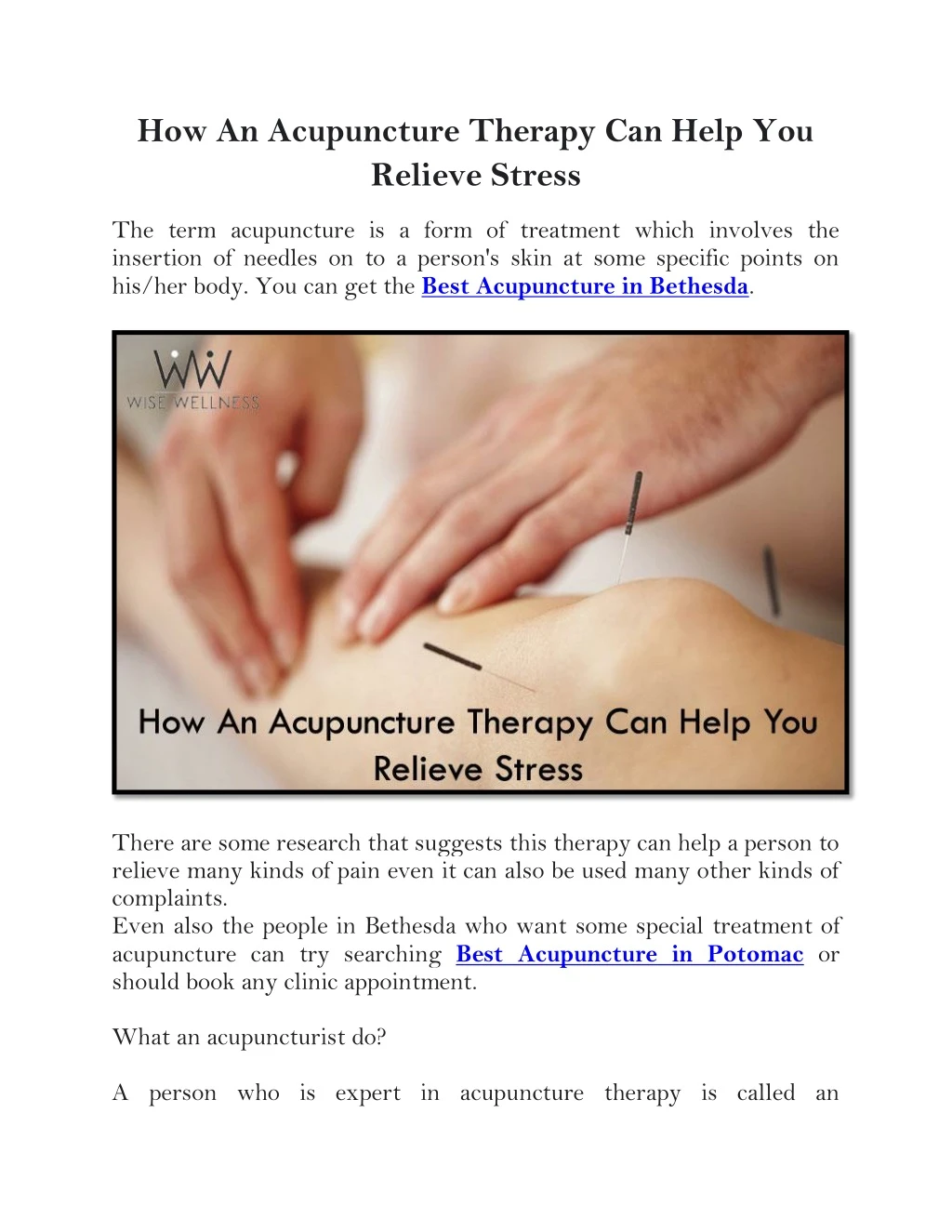 how an acupuncture therapy can help you relieve