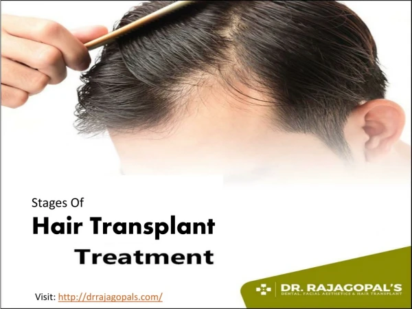 Stages Of Hair Transplant Surgery - Dr. RajaGopal's Clinic.