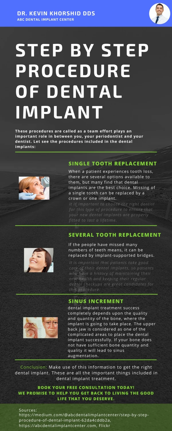 Step By Step Procedure of Dental Implant