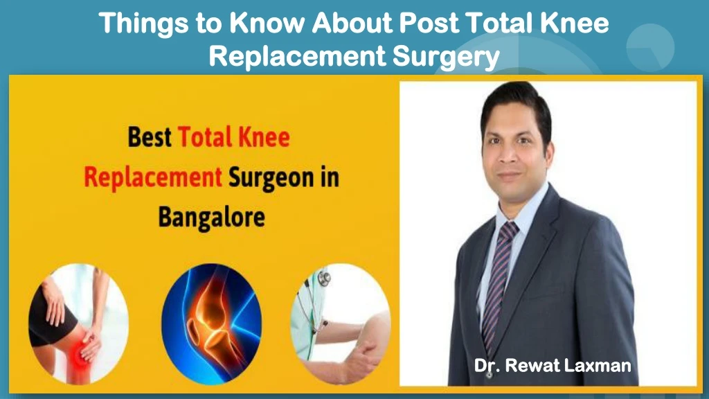 things to know about post total knee replacement