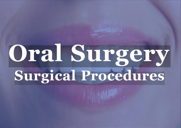 Types of Oral Surgery and What to Expect