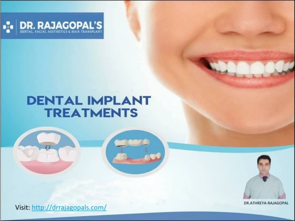 Dental Implants in Gurgaon - Dr. RajaGopal's Clinic