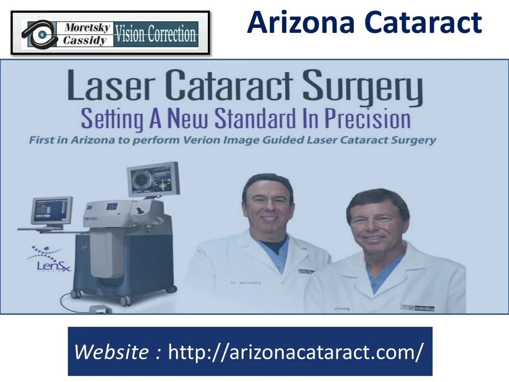 arizona cataract