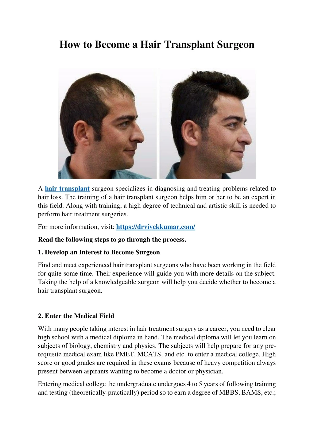 how to become a hair transplant surgeon