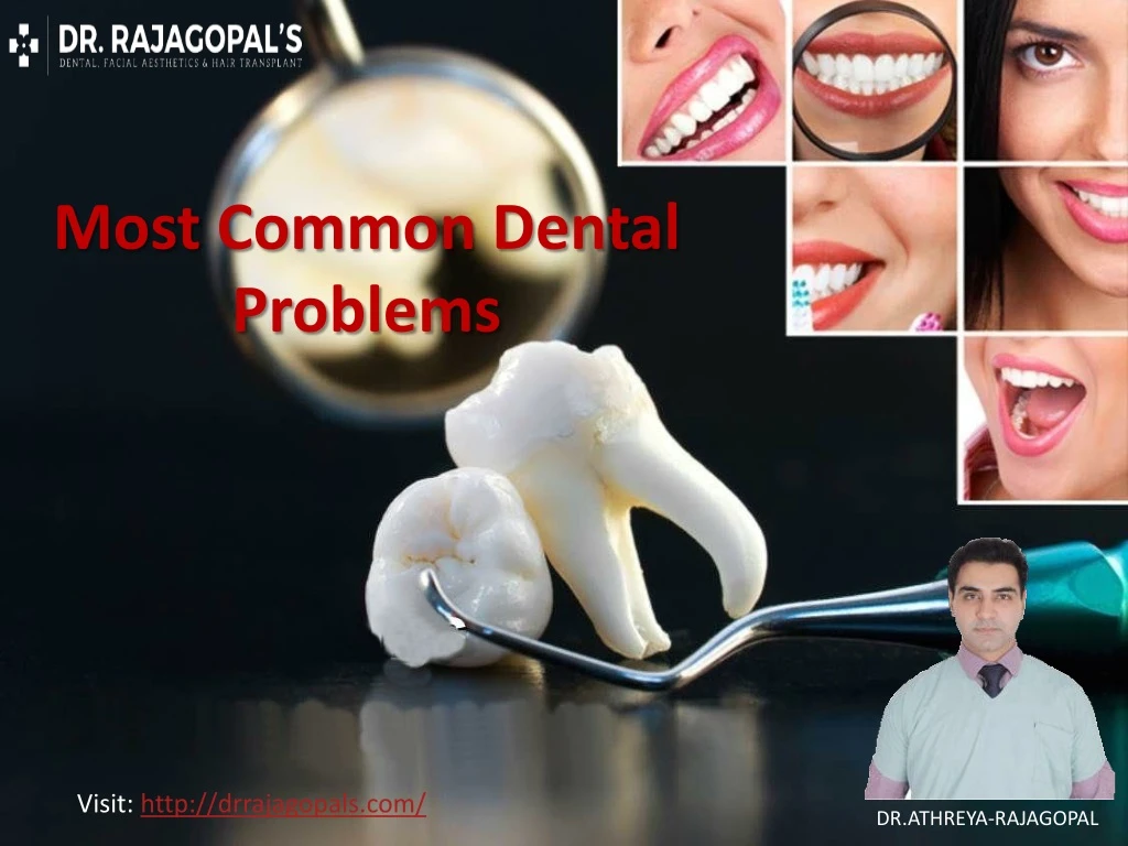 most common dental problems