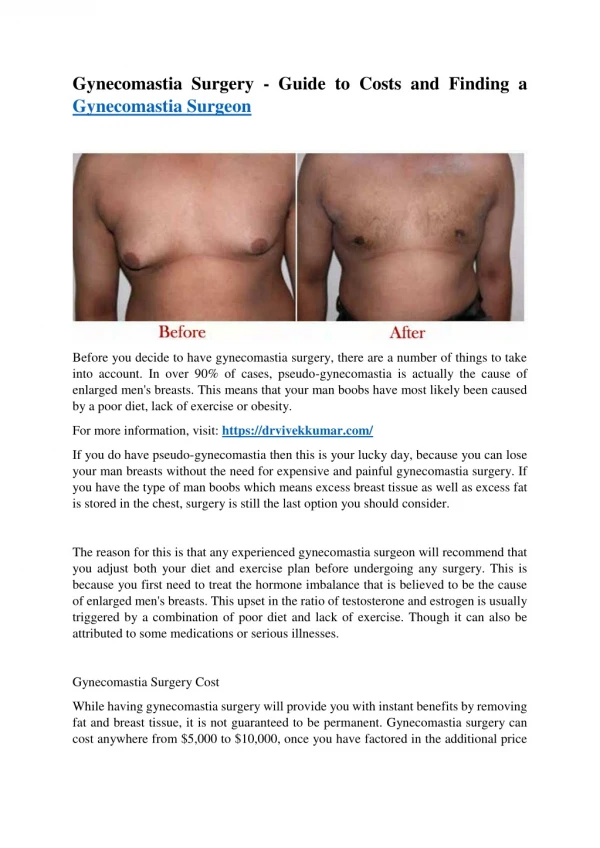 Gynecomastia Surgery - Guide to Costs and Finding a Gynecomastia Surgeon