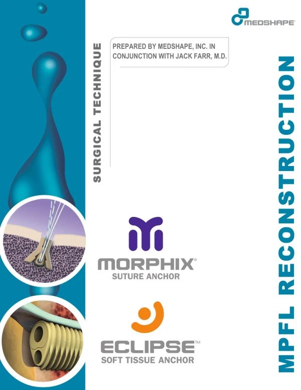 MPFL Reconstruction - Surgical Technique Guide | MedShape