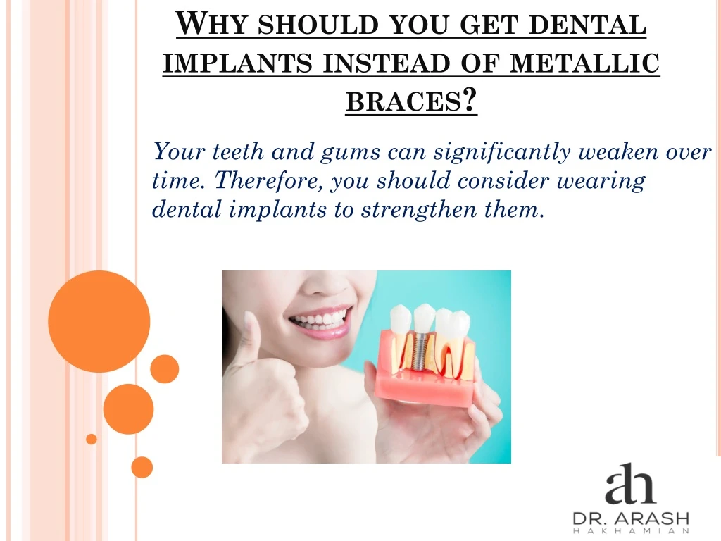why should you get dental implants instead of metallic braces