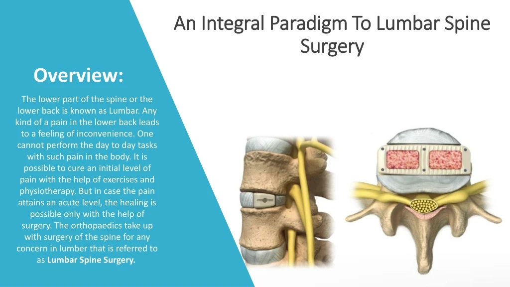 an integral paradigm to lumbar spine surgery
