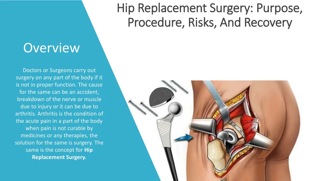 hip replacement surgery purpose procedure risks and recovery