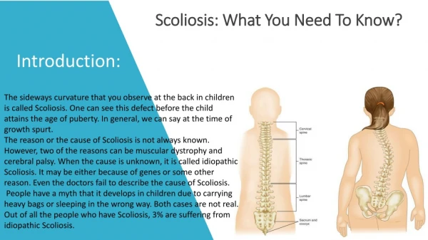 Scoliosis: What You Need To Know?