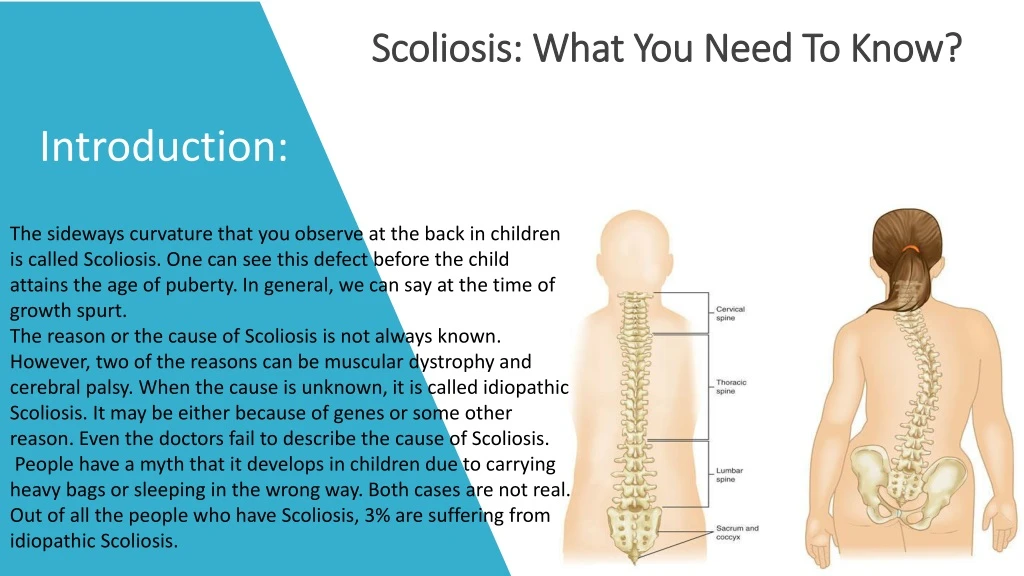 scoliosis what you need to know