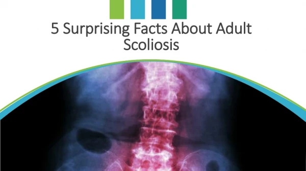 5 Surprising Facts About Adult Scoliosis