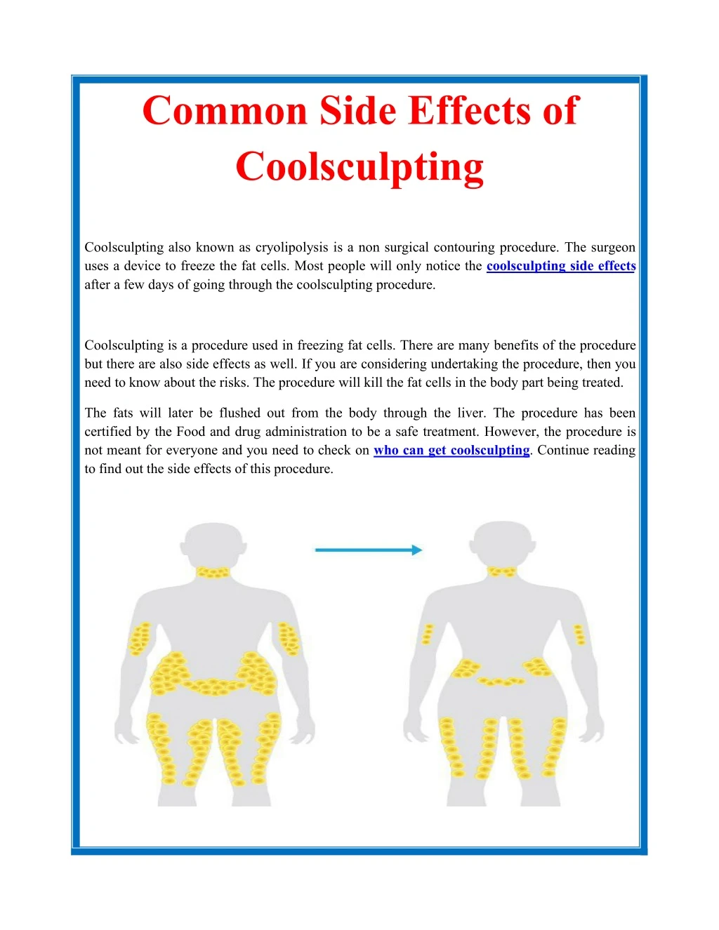 common side effects of coolsculpting