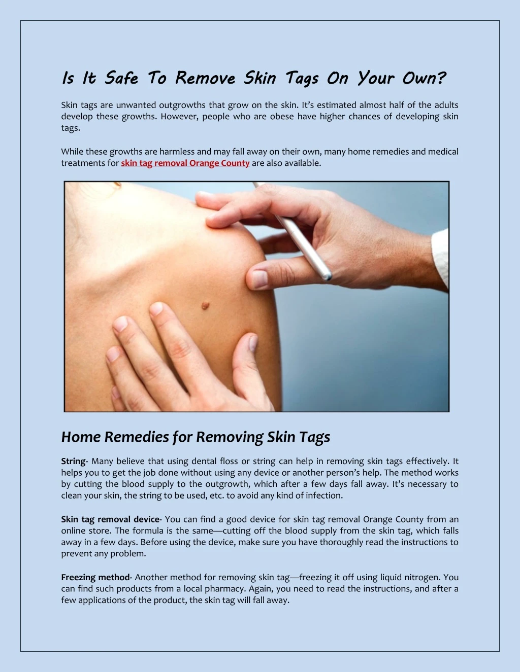is it safe to remove skin tags on your own skin
