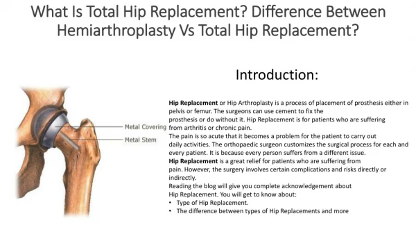 What Is Total Hip Replacement? Difference Between Hemiarthroplasty Vs Total Hip Replacement?